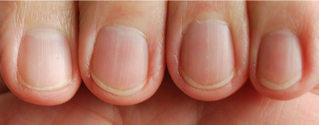 finger and toenail testing